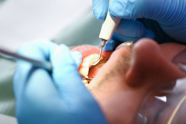 Best Emergency Dental Care for Sports Injuries in Warsaw, IL