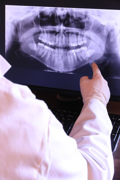 Best Emergency Denture Repair in Warsaw, IL